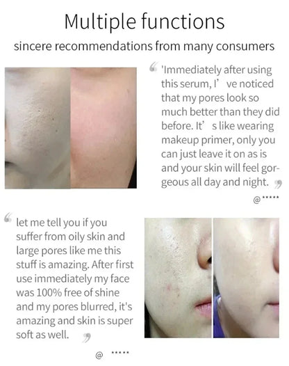 Pore Shrinking Serum Peeling Face Removing Large Pores Tightening Repairing Facial Pore Minimizing Effective Exfoliation Skin