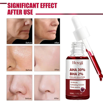 Pore Shrinking Serum Peeling Face Removing Large Pores Tightening Repairing Facial Pore Minimizing Effective Exfoliation Skin